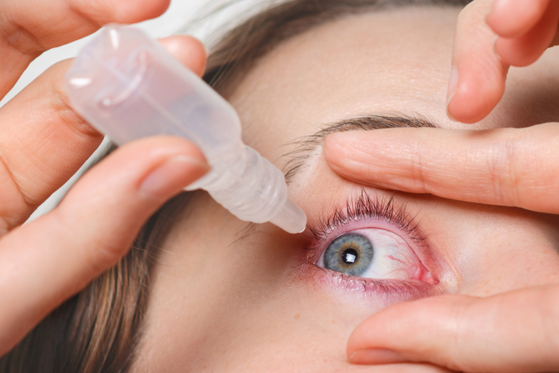 Tratamento da ros&aacute;cea ocular avan&ccedil;a com uso de tecnologia