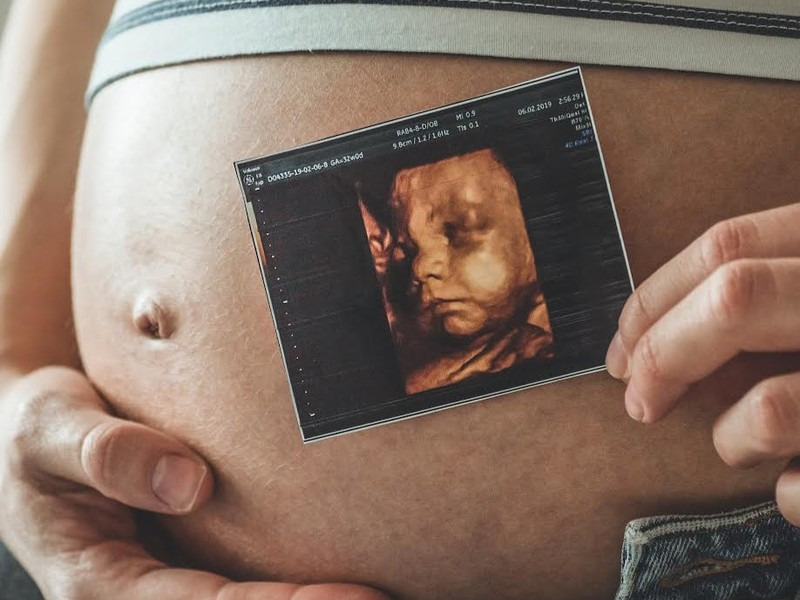 Ultrassonografia obst&eacute;trica avan&ccedil;a no diagn&oacute;stico pr&eacute;-natal